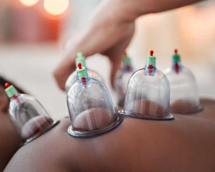 flower-of-life-cuppinge-therapy-healing