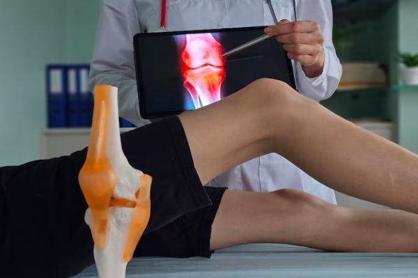 kneecap-dislocation-treatment-manchester-big-0
