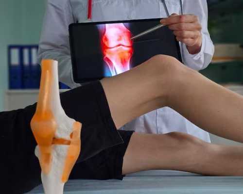 kneecap-dislocation-treatment-manchester
