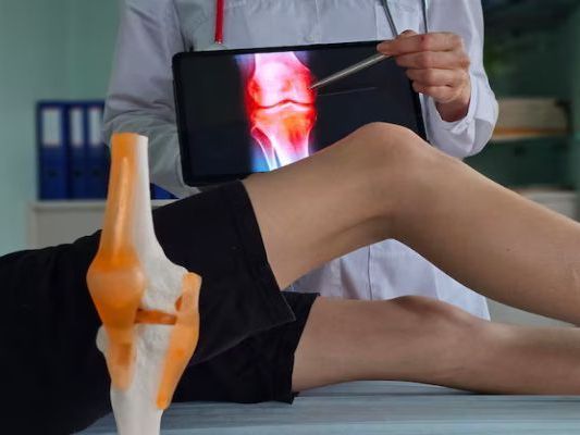kneecap-dislocation-treatment-manchester