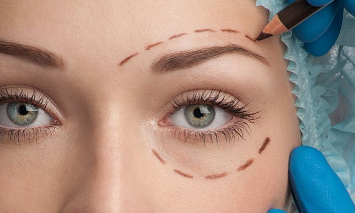 best-blepharoplasty-windsor-eyelid-surgery-clinic-near-you-big-0