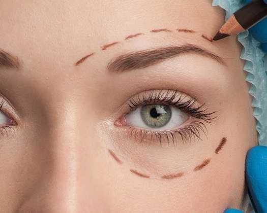 best-blepharoplasty-windsor-eyelid-surgery-clinic-near-you