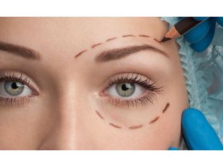 best-blepharoplasty-windsor-eyelid-surgery-clinic-near-you-small-0