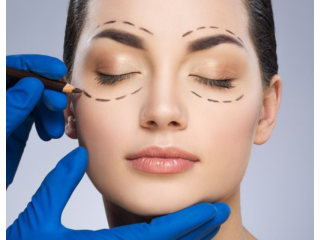 best-blepharoplasty-windsor-eyelid-surgery-clinic-near-you-small-1
