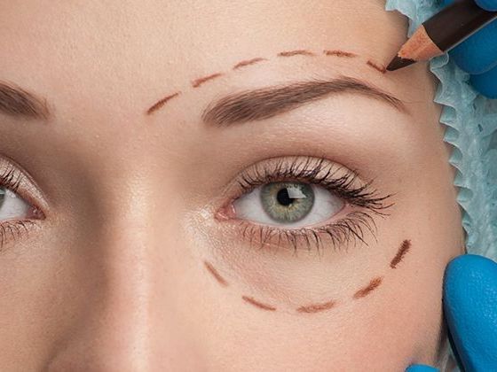 best-blepharoplasty-windsor-eyelid-surgery-clinic-near-you