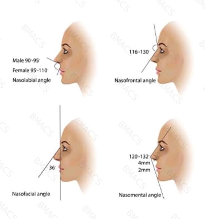 dermal-filler-nose-job-in-chiswick-no-surgery-no-downtime-big-0