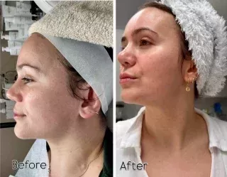 advanced-skin-care-laser-treatments-in-maidenhead-big-0