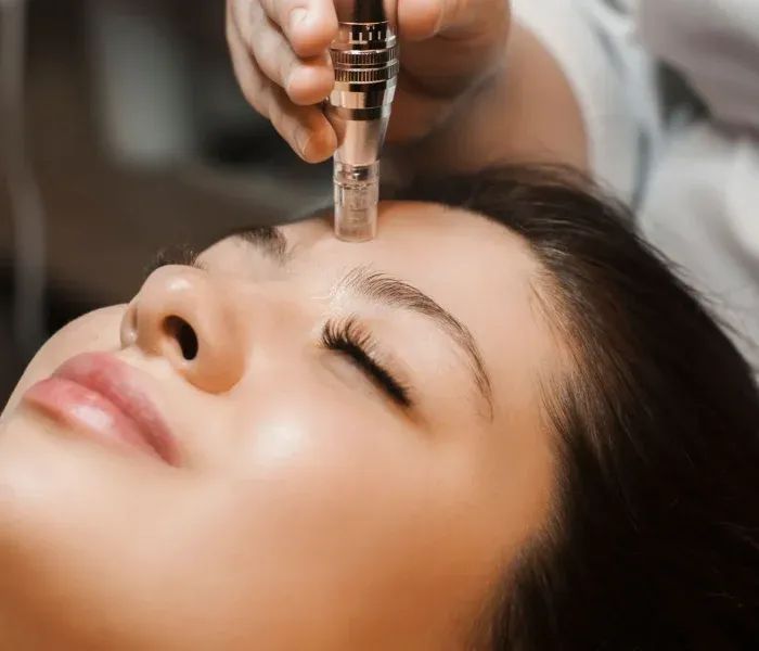 advanced-skin-rejuvenation-near-islington-london-big-0