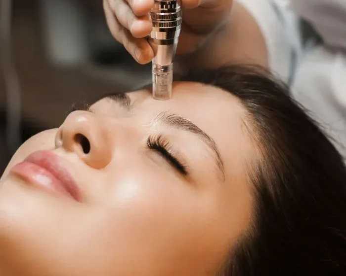 advanced-skin-rejuvenation-near-islington-london