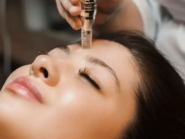 advanced-skin-rejuvenation-near-islington-london