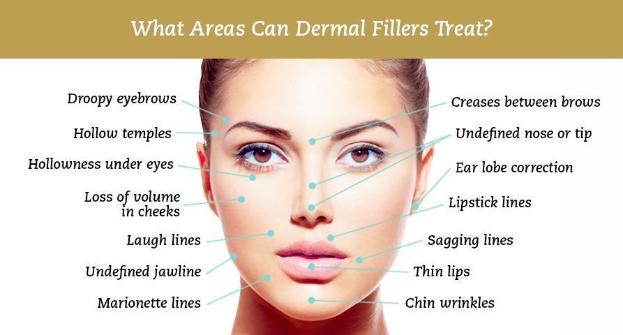 dermal-fillers-treatments-in-uk-big-0