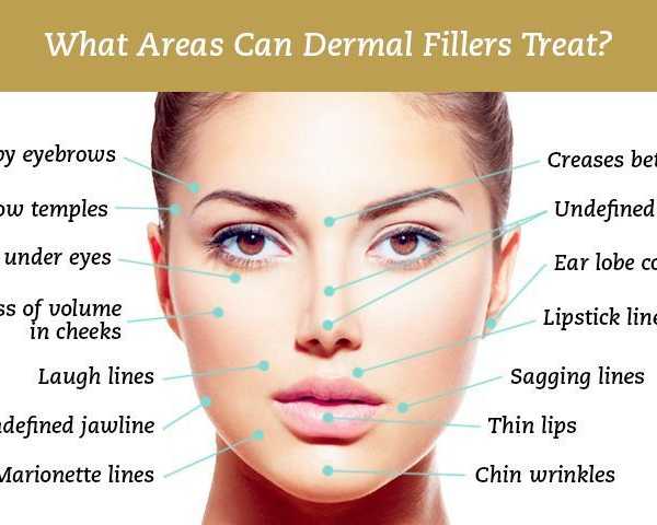dermal-fillers-treatments-in-uk