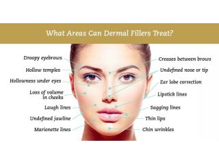 dermal-fillers-treatments-in-uk-small-0