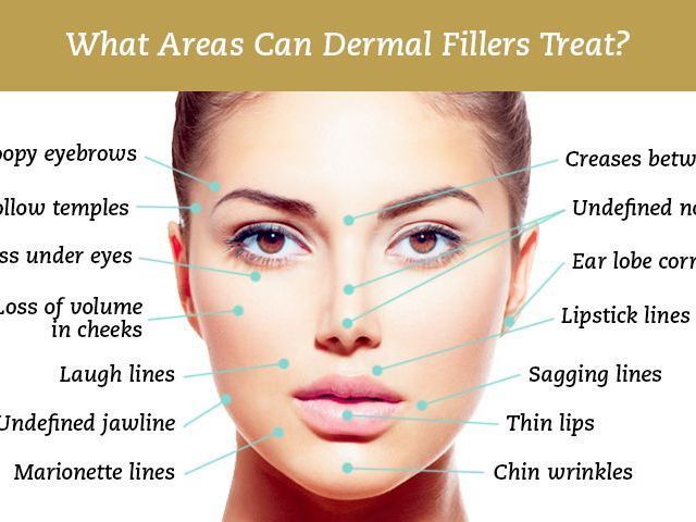 dermal-fillers-treatments-in-uk
