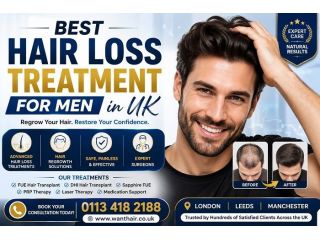 leading-uk-clinic-for-mens-hair-loss-treatment-small-0