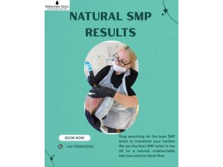 best-smp-results-achieve-a-natural-fuller-hairline-small-0