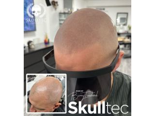 premium-hair-pigmentation-services-in-london-skulltec-small-0