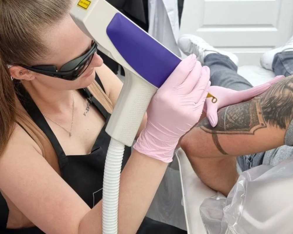 advanced-laser-tattoo-removal-training-for-beginners-and-pros