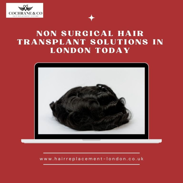 non-surgical-hair-transplant-solutions-in-london-today-big-0