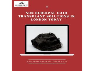 non-surgical-hair-transplant-solutions-in-london-today-small-0
