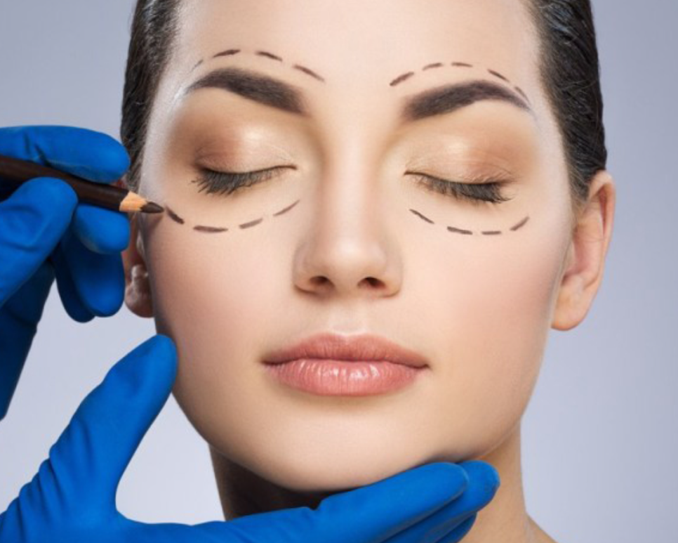 eyelid-surgery-in-windsor-bmacs
