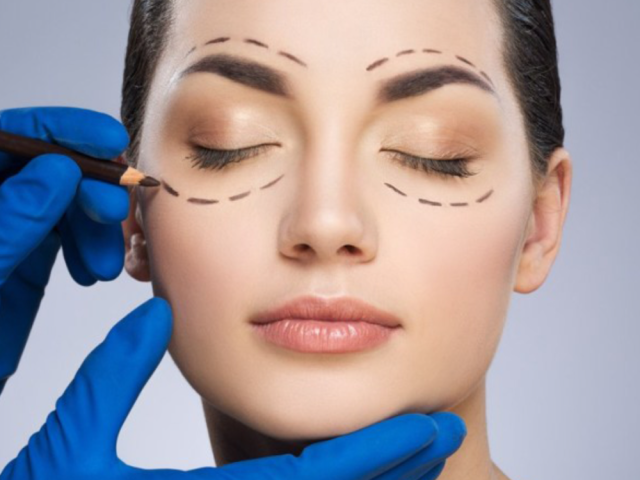 eyelid-surgery-in-windsor-bmacs