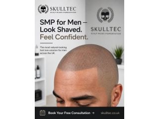 smp-for-men-in-london-expert-hair-loss-solutions-by-skulltec-small-0
