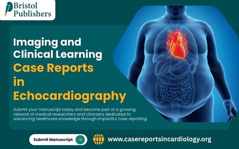 submit-your-case-reports-in-echocardiography-big-0