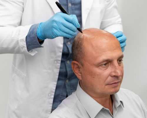 advanced-hair-replacement-services-for-men-in-london