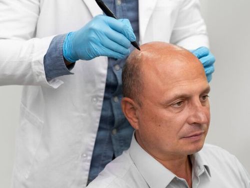advanced-hair-replacement-services-for-men-in-london