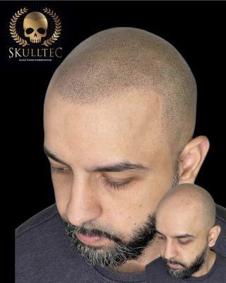 hair-tattoo-hairline-tattoo-for-men-skulltec-big-0