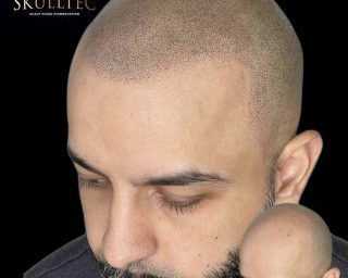 hair-tattoo-hairline-tattoo-for-men-skulltec