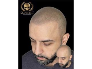 hair-tattoo-hairline-tattoo-for-men-skulltec-small-0
