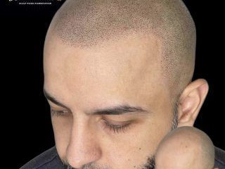 hair-tattoo-hairline-tattoo-for-men-skulltec