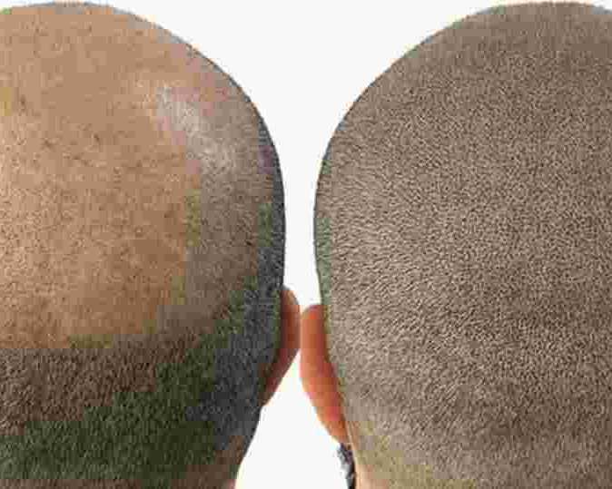 professional-hair-pigmentation