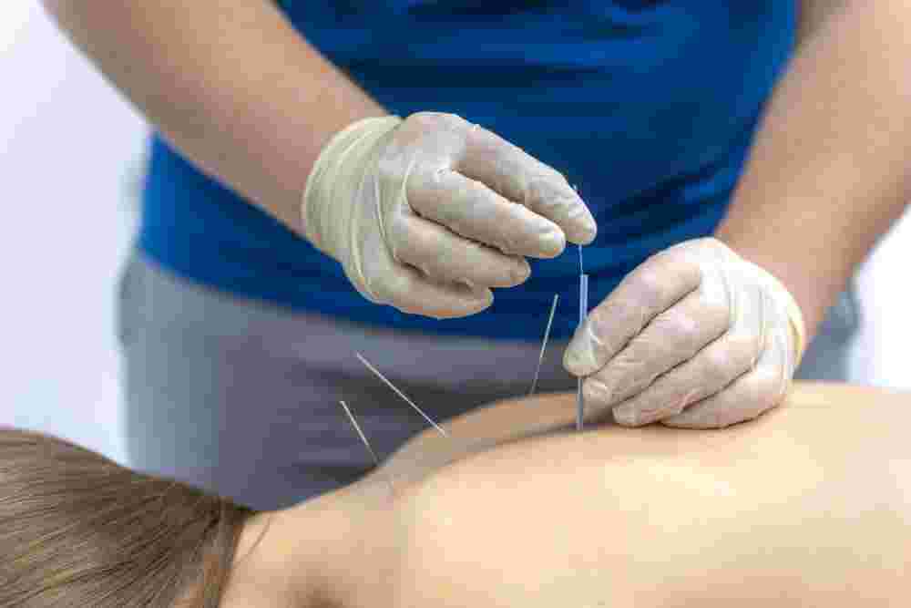 central-london-acupuncture-for-natural-pain-relief-big-0