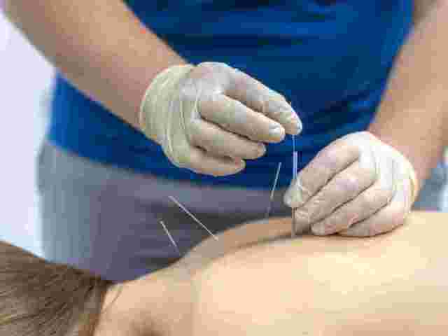 central-london-acupuncture-for-natural-pain-relief