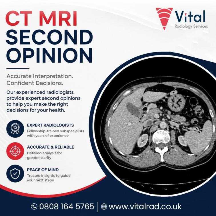 ct-mri-second-opinion-services-for-expert-diagnostic-accuracy-big-0