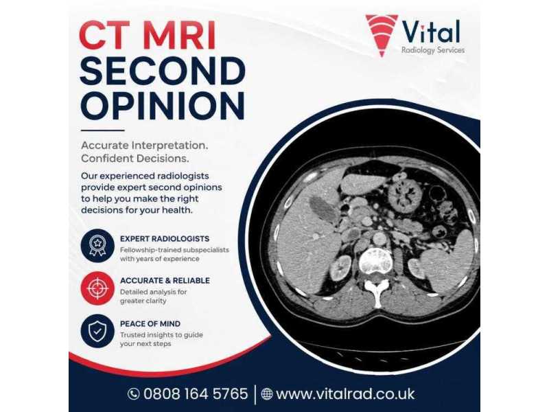 ct-mri-second-opinion-services-for-expert-diagnostic-accuracy-small-0