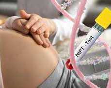 affordable-nipt-blood-test-provider-uk