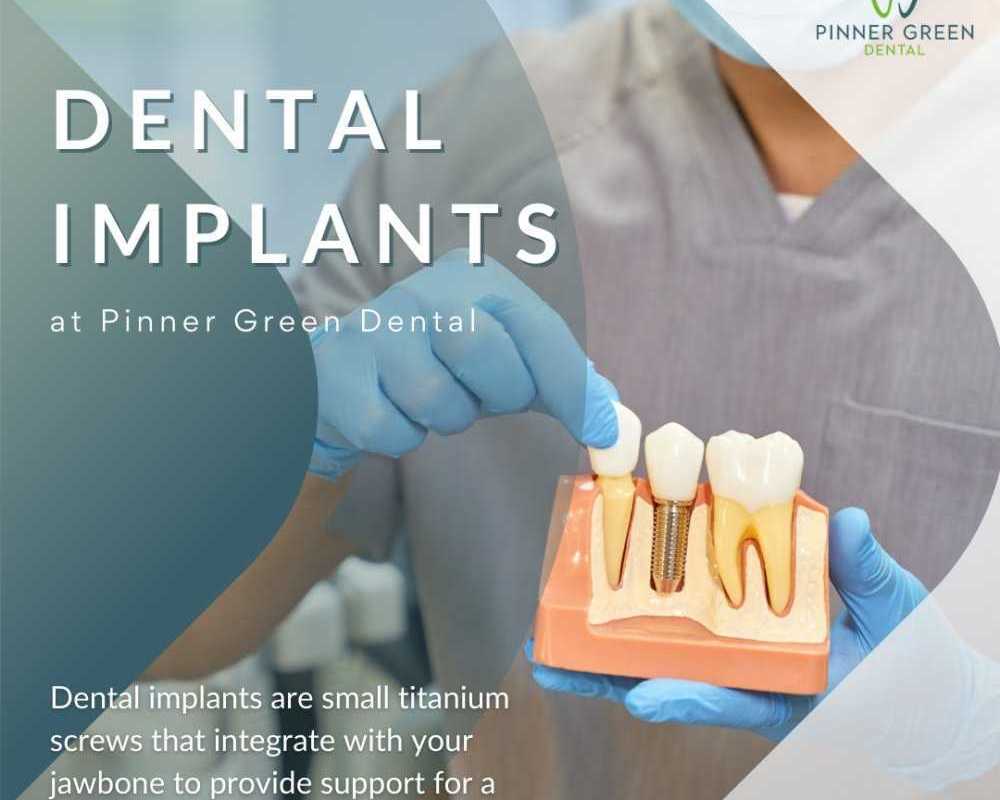 dental-implants-in-pinner-for-permanent-tooth-replacement