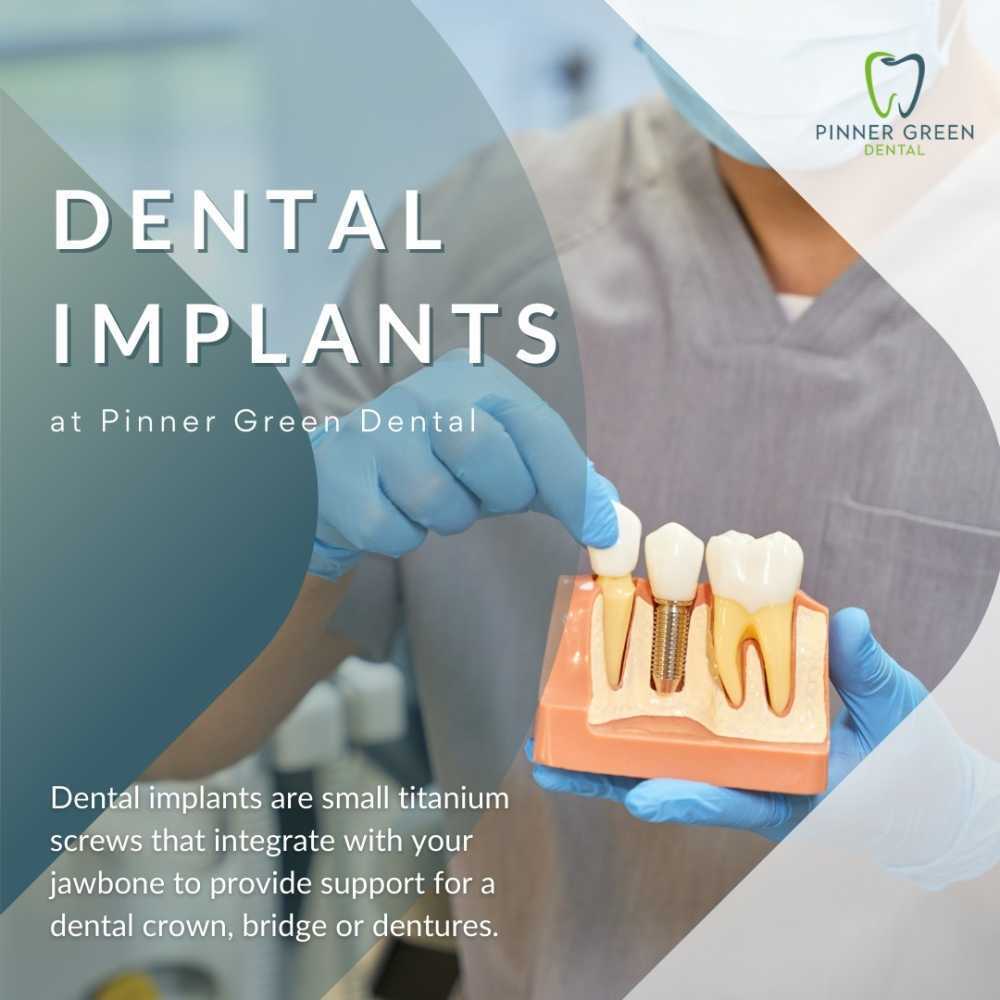 dental-implants-in-pinner-for-permanent-tooth-replacement-big-0