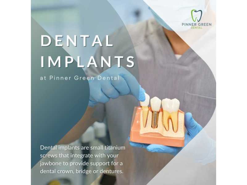dental-implants-in-pinner-for-permanent-tooth-replacement-small-0