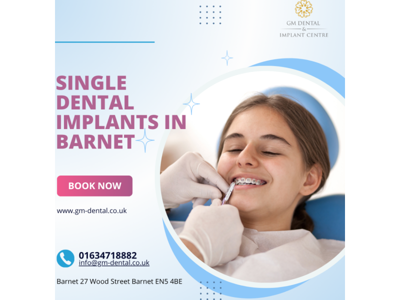 single-dental-implants-in-barnet-for-missing-tooth-small-0