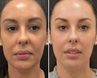 skin-clinic-leeds-expert-aesthetic-treatments-for-radiant-skin