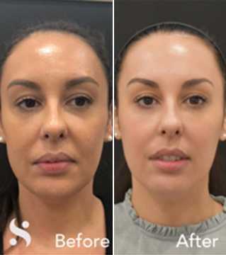 skin-clinic-leeds-expert-aesthetic-treatments-for-radiant-skin-big-0