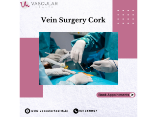 Vein surgery in Cork: Is it necessary?