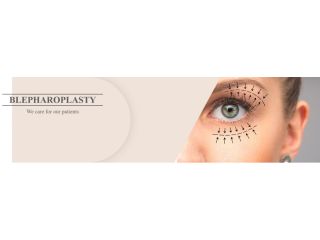 blepharoplasty-cost-in-mumbai-dr-parag-telang-small-0