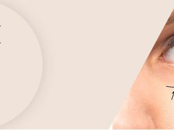 blepharoplasty-cost-in-mumbai-dr-parag-telang