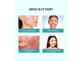 dr-sakhiyas-acne-care-kit-best-skin-care-kit-for-acne-prone-skin-dermatologist-recommended-small-2